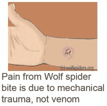 Mechanical trauma is what hurts from Wolf spider bites 